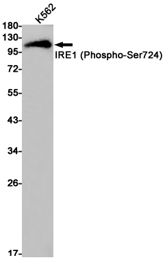Phospho-IRE1 (Ser724) Rabbit mAb